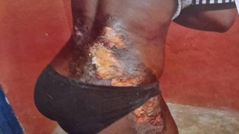 Trader pours hot water on daughter for taking her GH¢5 for food